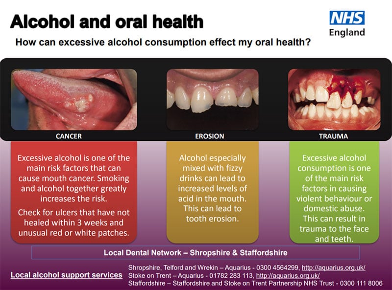 Does Consuming Alcohol Have An Impact On The Appearance of Teeth 1