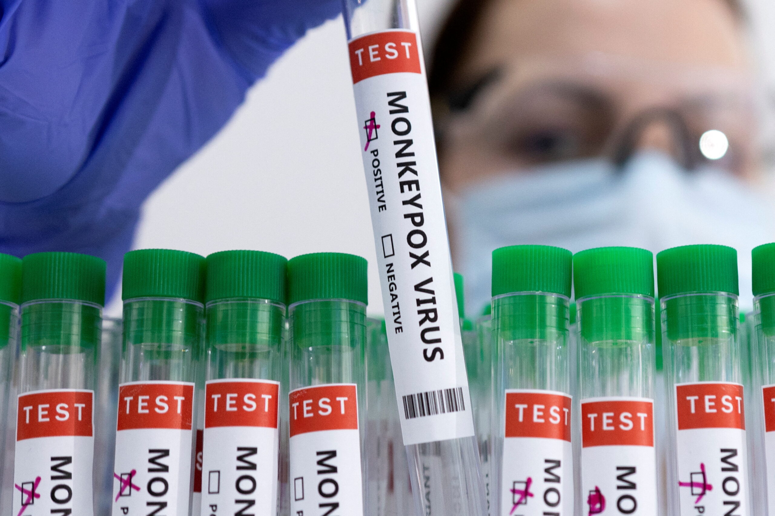 Huachenyang Monkeypox Virus PCR Test Kit Was Registered By MHRA In UK 1