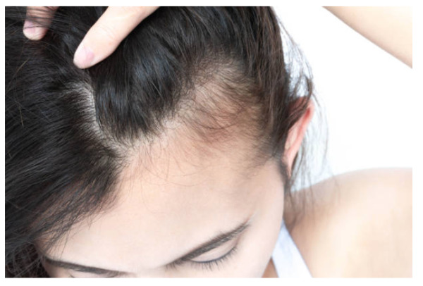 Trichology Centre shares new post about women hair loss and solutions 3