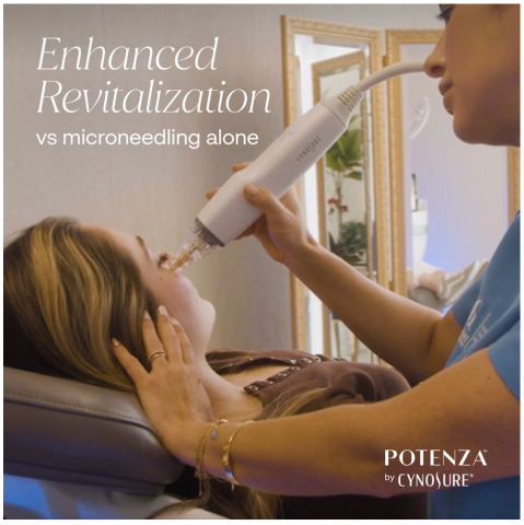 Laser Skin Clinic introduces Potenza RF Microneedling for enhanced Skin Tightening, Acne Scars, and Stretch Marks 1