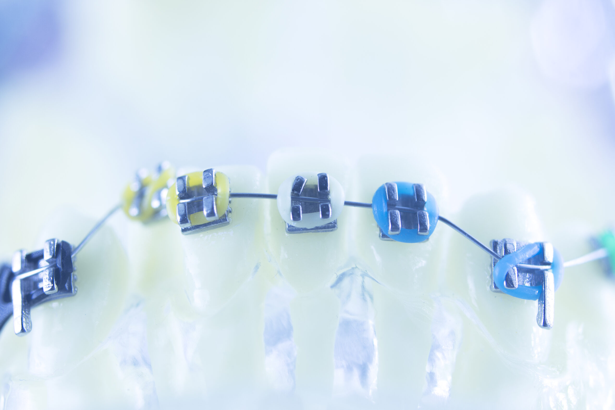 Explore the Orthodontic Treatments, Its Benefits, and How it Improves Individual’s Appearance 1